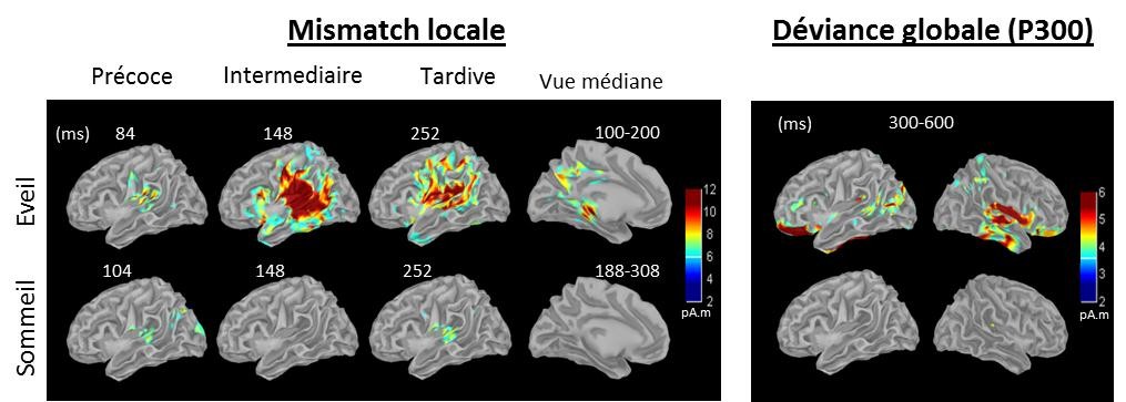 Le sommeil réduit les capacités de prédiction du cerveau | Institut du ...