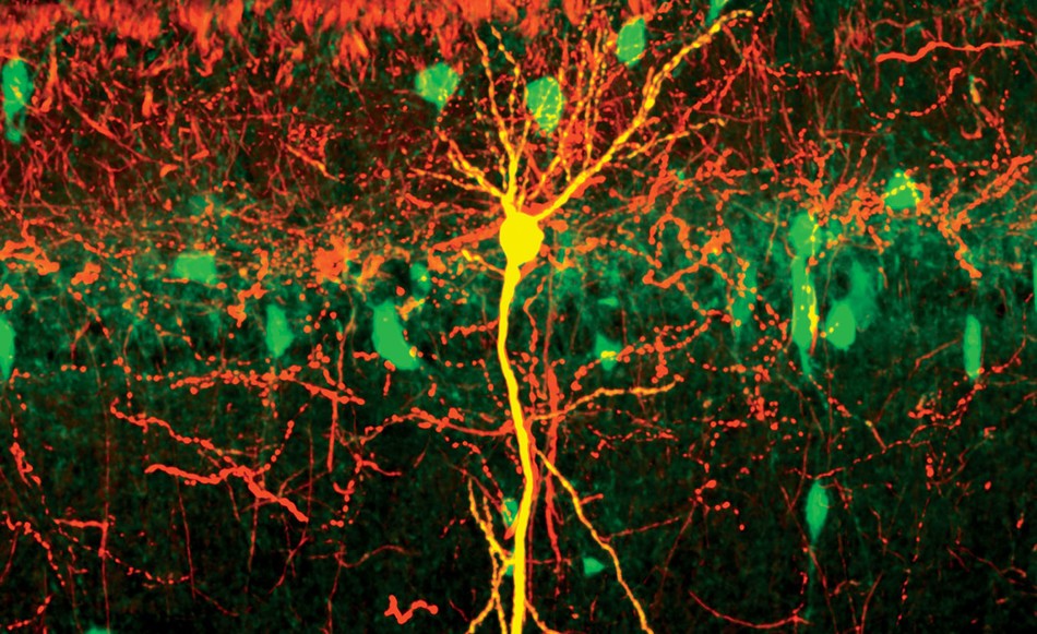 Les causes de la maladie d Alzheimer| Institut du Cerveau