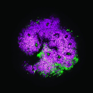 Organoïde cortical en microscopie confocale