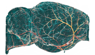 cerveau imagé en 3D par microscopie en feuillet de lumière