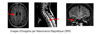 Image d'une IRM