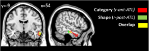 schéma cerveau