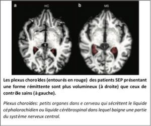 cerveau