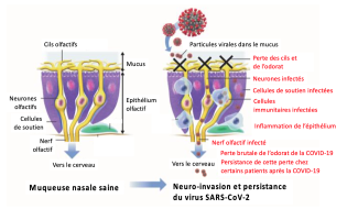 Schéma représentant les différentes étapes qui surviennent au niveau de l’appareil sensoriel et qui concourent à l’anosmie liée à la Covid-19.