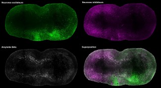 Brain Functional Genome Program