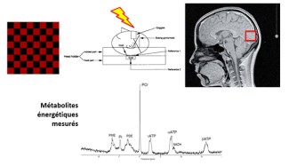 Mesure du métabolisme énergétique du cerveau