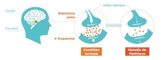 Le rôle de la dopamine dans la maladie de Parkinson