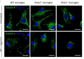 Microscopie confocale du réseau mitochondrial