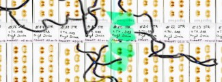 Nouvel espoir Parkinson et maladie neurodégénératives