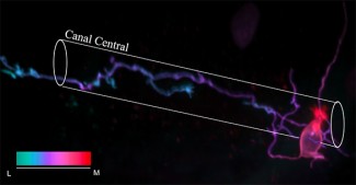 Un marquage mosaique permet d’identifier la morphologie d’un neurone contactant le liquide céphalorachidien dans la moelle épinière de la larve du poisson zèbre. La cellule comporte une brosse de microvilli (rouge – rose) qui baignent dans la lumière du canal central et un axone (violet – bleu) ascendant dans la moelle épinière ventrale. © Caleb Stokes et Claire Wyart – Institut du Cerveau - ICM