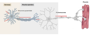 neurones pyramidaux ou cortico-spinal et de motoneurones 