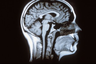 Cabanis, Emmanuel-Alain / Sagittal section of the human brain © Institut du Cerveau - ICM