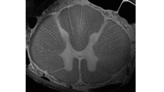 Image en 3D d'échantillons ex vivo de la moelle épinière