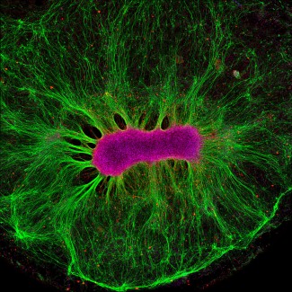 Organoïde de cerveau. Crédit : Wellcome Images.