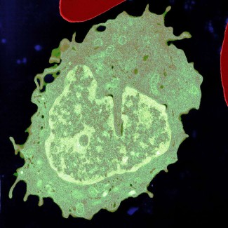 monocyte