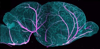 Comment les vaisseaux sanguins cérébraux se construisent après la naissance