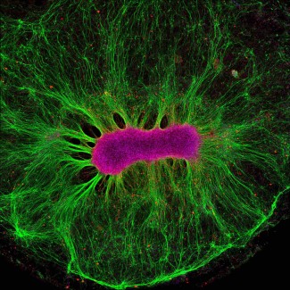 Organoïde de cerveau. Crédit : Wellcome Images.