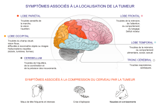 symptômes des tumeurs cérébrales