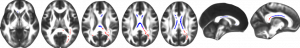 cerveau