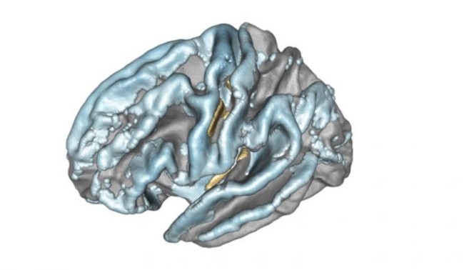 Une nouvelle méthode statistique pour améliorer la cartographie ...
