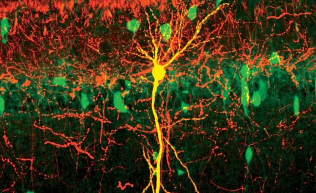 Quels sont les mécanismes biologiques de la maladie d Alzheimer